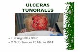 ULCERAS TUMORALES PIEL blog [Modo de compatibilidad] · CARACTERÍSTICAS ÚLCERAS TUMORALES 1. Sangrado, por fragilidad capilar. 2. Infección, a causa del crecimiento bacteriano