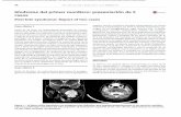 Síndrome del primer mordisco: presentación de 2 casos - scielo.isciii.esscielo.isciii.es/pdf/maxi/v39n1/1130-0558-maxi-39-01-00044.pdf · dico a nivel de la región preauricular,