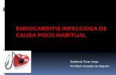 ENDOCARDITIS+INFECCIOSA+DE+ CAUSA+POCO+HABITUAL+ - Hospital de … · observándose imágenes sugestivas de infartos esplénicos. - Hemocultivos: Crecimiento de Streptococcus gallolyticus
