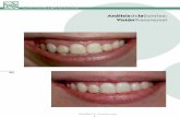 AnálisisdelaSonrisa: VisiónTransversal · de “dentadura completa”. Segundo, cuando se realiza la expansión de la zona anterior del maxilar superior, el arco de DR. RRAFAEL