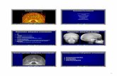 Aplicación Multimedia para la Enseñanza de Radiología a ... · 3 Aplicación Multimedia para la Enseñanza de Radiología a Alumnos de Medicina 13/35 Regiones del cuello suprahiohideo