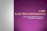 L’ELECTROCARDIOGRAMA EN LA CARDIOPATIA … · La repolarització s’inicia a l’endocardi (invers). El teixit isquèmic genera un vector que s’allunya de l’àrea isquèmica