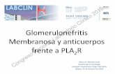 Glomerulonefritis frente a PLA R - labclin2018.es 25... · PROTEINURIA NO NEFROTICA (20%): Evolución favorable, función renal estable y sin hipertensión 80% con SN Congreso Nacional