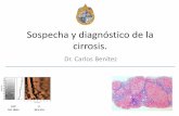 Sospecha y diagnóstico de la cirrosis. · Introducción •La cirrosis hepática es una enfermedad común y se encuentra entre las principales causas de muerte en Chile. •Su diagnóstico