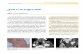 ¿Cuál es su diagnóstico? - SciELO Españascielo.isciii.es/pdf/maxi/v30n6/en_residente1.pdf · plazando las estructuras vecinas. Además, la vena yugular interna estaba amputada
