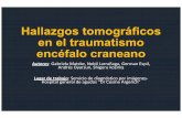 Hallazgos tomográficos en el traumatismo encéfalo craneano · CLASIFICACIÓN lesiones primarias y secundarias LESIONES PRIMARIAS LESIONES SECUNDARIAS 1) Scalp: cefalohematoma, hematoma
