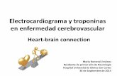 Electrocardiograma y troponinas en enfermedad cerebrovascular · Índice •Tipos de enfermedad cerebrovascular. •Relevancia clínica. •Fisiopatología. Porqué se producen estas