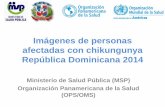 Imágenes de personas afectadas con chikungunya República ... · 28 años, 28 semanas de embarazo. Con trastorno hipertensivo del embarazo y lesiones eritematosas en piel 34. 28