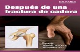 Después de una fractura de cadera (PDF) · Las fracturas de cadera son más comunes en personas con osteoporosis (una enfermedad que hace que los huesos se debiliten). La cabeza