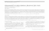 Flegmasia cerulea dolens. Reporte de caso · Phlegmasia cerulea dolens (phlebitis, cyanosis, pain) is a rare disease that uncommonly affects the upper limbs (5- ... no significativos