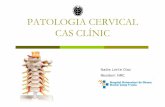 PATOLOGIA CERVICAL CAS CLÍNIC - academia.catMielopatia Cervical Espondilòtica (MCE) Epidemiologia: Freqüent H, >50a (infreq 55a Majoria