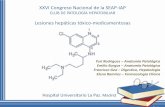 XXVI Congreso Nacional de la SEAP-IAP · Hidroxicloroquina y Cloroquina El incremento de enzimas hepáticas ha sido reportado en menos de 1% de casos, aunque en pacientes con hepatitis
