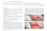 Injertos autólogos con sellos de pielcontacto íntimo con la base de la úlcera y el suministro sanguíneo (Jones JE, 2008). 3. Colocación y fijación del injerto: La piel, ya preparada,