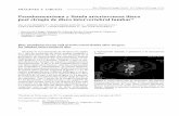Pseudoaneurisma y fístula arteriovenosa ilíaca post ... · sergiopacheco13@gmail.com Paciente de sexo femenino de 46 años con cuadro de 1 año de evolución de dolor lumbar irradiado