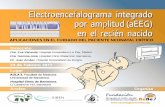 · Colocación de electrodos. Sistema 10-20 Internacional. Canales y montaje neonatal. ¿Qué es el EEG? Aspectos neurofisiológicos para la interpretación del aEEG. Electroencefalograma