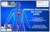 RESERVA FRACCIONAL DE FLUJO (FFR)caci.org.ar/assets/misc/docs/charlas/7-marcos-delavega.pdf · Valor de la reserva fraccional de flujo en la toma de decisiones acerca de la cirugía