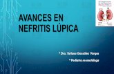 Avances en nefritis lupica...elevados en NL que en LESp sin nefritis (Pc