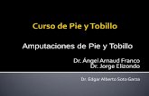 Amputaciones de Pie y Tobillo · 2014-11-06 · Técnica quirúrgica: 1. Incisión curvilínea 2. Los flaps deben dar cobertura a la parte distal de la falange proximal. 3. Flap en