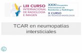 TCAR en neumopatías intersticiales · • Diferenciar Idiopática (IPF) vs secundaria • Las GUIAS para el diagnóstico ayudan a reconocer el patrón característico y muchas veces