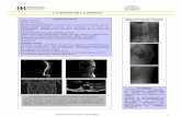 la imagen de la semana - Hospital Italiano de Buenos Aires · b) está documentado que el plexo venoso prevertebral de Batson drena las vísceras torácicas, abdominales y pelvianas