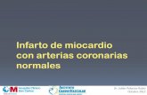 Infarto de miocardio con arterias coronarias normales · Infarto de miocardio con arterias coronarias normales Dr. Julián Palacios Rubio Octubre 2012