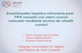 Encefalopatía hepática refractaria post TIPS resuelta con ... · Con un gradiente P-S menor de 12 mm Hg la paciente se encuentraba asintomática con respecto a la encefalopatía