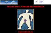 PET/TC EN EL CANCER DE PROSTATA colina. Dr. Jose Ramon Garcia.pdf · BIOPSIA PROSTATICA Bajo riesgo T1-T2a, PSA
