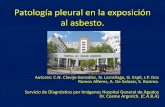 Patología pleural en la exposición al asbesto.congreso.sordic.org.ar/./uploads/2017/poster/2017_504_PE_Torax.pdf · •La enfermedad pleural por asbesto es una patología frecuente,