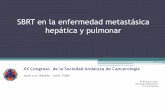 SBRT en la enfermedad metastásica hepática y pulmonar · •Factores favorables para la cirugía CEA normal ILE : > año Lesiones: < 3 SLE a 3 años de 49% •Factores pronósticos