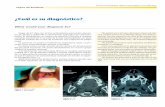 ¿Cuál es su diagnóstico?scielo.isciii.es/pdf/maxi/v31n2/residente.pdf · maxilar en 3 categorías: quistes fisurales, odontogénicos e infec-ciosos. Los quistes fisurales se subdividen