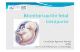 Guadalupe AguarónBenítez MIR 1 Servicio de Obstetricia y ...€¦ · Documento gráfico y continuo Importancia desde punto de vista médico-legal. ... Arritmias fetales método