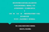 camilo hernandez-RECONSTRUCCION DEL LIGAMENTO ... · Medial tendón del cuádriceps-femoral Ligamento: anatomía quirúrgica y técnica de reconstrucción para prevenir la rótula