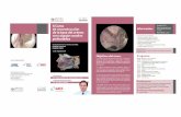 Curso Colgajosbarnacraneo.es/.../uploads/2016/10/Curso-Colgajos.pdf · En este curso se revisará en piezas anatómicas las referencias anatomo-quirúrgicas y la vascularización