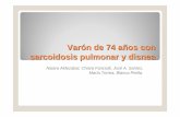 Varón de 74 años con sarcoidosis pulmonar y disnea...Caso clínico • Varón de 74 años con sarcoidosis pulmonar y disnea • ANTECEDENTES PERSONALES:-HTA, DM-2. - Exfumador sin