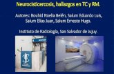 Neurocisticercosis, hallazgos en TC y RM. · PDF file 2017-05-10 · •Neurocisticercosis. Hallazgos radiológicos.Imaging findings in neurocisticercosis. Unitat de Ressonància Magnètica
