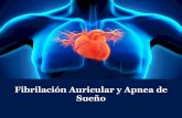 Fibrilación Auricular y Apnea de Sueño · Fibrilación auricular- aislamiento de venas pulmonares y SAHOS El aislamiento de las venas pulmonares (AVP) es el tratamiento de los pacientes