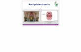 Amigdalectomía - Área Salud Badajoz · INDICACIONES QUIRÚRGICAS !PROCESOS INFECCIOSOS Amigdalitis de repetición: • 7 + episodios al año o en el último año •5 episodios