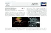 Pericarditis constrictiva y arteria coronaria única: Una ...archivoscardiologia.com/previos/(2018) ACM Vol 88...La tomografía computada mul-ticorte es también importante para evaluar