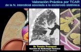 Valoración Práctica por TCAR de la N. intersticial ... · Enfermedad generalizada del tejido conectivo Afectación pulmonar frecuente Sintomatología respiratoria inicial < 1% casos