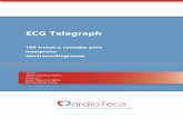 ECG Telegraph - CardioTeca€¦ · crecimiento de la aurícula derecha producen los mismos signos en el ECG?..... 15 #ECG_Telegraph 8. ¿Sabes qué ... ¿Podemos saber si una extrasístole