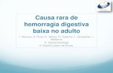 Causa rara de hemorragia digestiva baixa no adulto - NGHD · 2019-01-03 · Causa rara de hemorragia digestiva baixa no adulto I. Mocanu, S. Pires, N. Veloso, R. Godinho, L. Gonçalves,