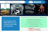 Embolia Pulmonar Séptica - Repositorio EdocURrepository.urosario.edu.co/.../embolia_pulmonar.pdf · La embolia pulmonar séptica (EPS) se define como la presencia de trombos sépticos