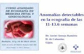 Anomalías detectables en la ecografía de las 11-13.6 semanas...en la ecografía de las 11-13.6 semanas . ... Borrell A, Robinson JN, Santolaya-Forgas J. Clinical value of the 11-