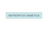 NEFROPATÍA DIABÉTICA · 2017. 5. 19. · • Recaídas y remisiones • Nefropatía más severa en hombres y niños • Etiología: factores genéticos, autoinmunidad con formación