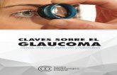 CLAVES SOBRE EL GLAUCOMA...Indicada para el tratamiento del glaucoma primario de ángulo abierto. El haz de láser abre los canales de líqui-do del ojo para contribuir a que el sistema