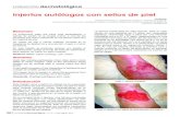 Injertos autólogos con sellos de piel · empeine del pie derecho con una cavidad en la parte externa de la úlcera, donde a la exploración se palpa capa cortical ósea y sin signos