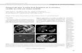 Imagen del mes: Lesión focal hepática en el cirrótico ...Gastroenterol. latinoam 2019; Vol 30, Nº 1: 39-43 Imagen del mes: Lesión focal hepática en el cirrótico, cuando no todo