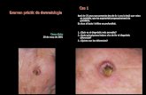 Cas 1 Examen pràctic de dermatologiadermatoweb2.udl.es/examenes_clinicos/ExamClin01m.pdf · 6. Dishidrosis 7. Tinya facial (incognito) 8. Condilomes acuminats 9. Alopècia areata