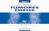 Fax 00 34 91 455 04 75 CURSO ONLINE DE TUMORES ÓSEOS · 0.3 Generalidades de la cirugía ortopédica oncológica 0.4 Técnicas de resección y reconstrucción en extremidades 0.5