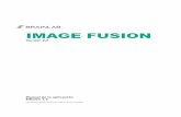 IMAGE FUSION - Brainlab User Guides · Image Fusion propone una cadena de fusión basada en reglas de emparejamiento predefinidas. Para obtener información adicional póngase en